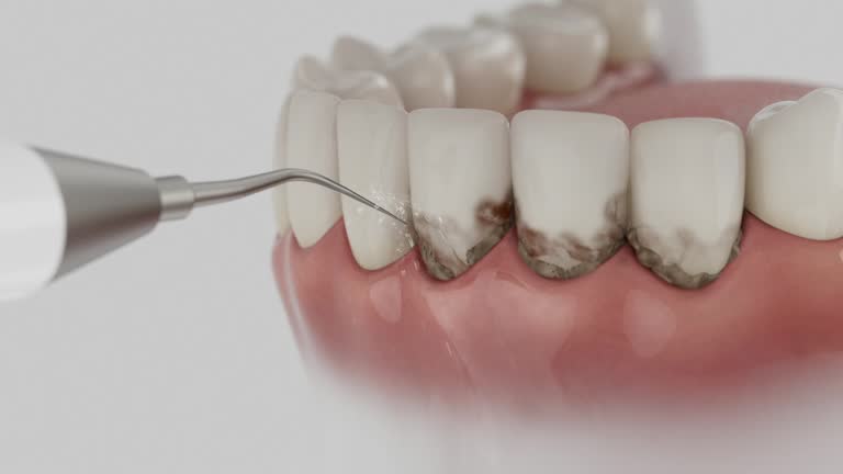 Reliable Dental contractor in Eagle, ID by Smile Center Dentistry